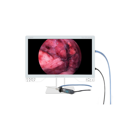 Het laatste nieuws van het bedrijf over Draagbare endoscoopcamera's brengen nauwkeurigheid en flexibiliteit in de moderne diagnose