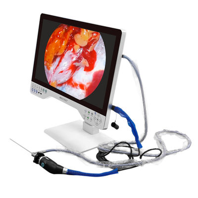 kopen Elektrische 4K-camera voor medische endoscopie met ingebouwde lichtbron en USB-opname online vervaardiging