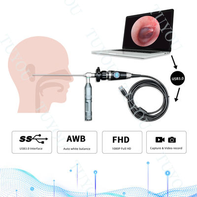 kopen Vervaardiging Draagbare USB3.0 Endoscoop Handle Camera Voor Medische ENT Inspectie online vervaardiging