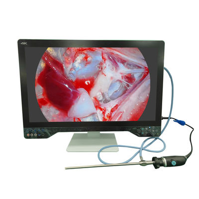 kopen Ultra High Definition Endoscope Camera 4K voor laparoscopie met 32