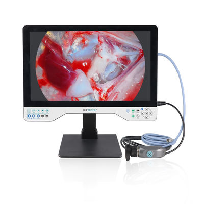 kopen Laparoscopie Cystoscoop Operaties 24