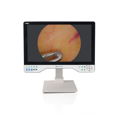 kopen 24 inch Laparoscopisch Monitor 4K UHD Endoscoop Camera System Chirurgische LED Met Lichtbron online vervaardiging