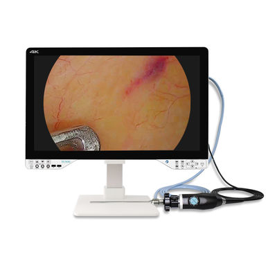 kopen 27 inch endoscoop 4K voor laparoscopische chirurgie met lichtbron en monitor online vervaardiging