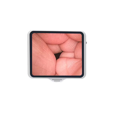 kopen TUYOU flexibele endoscoop met 3,5 inch scherm, herbruikbaar voor glasvezel bronchoscopie en huisdiergezondheid online vervaardiging