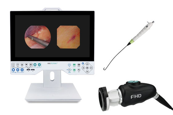 kopen TUYOU Brain Surgery Tool All-in-One Rigid & Flexible Endoscopy Camera System voor baarmoederonderzoek online vervaardiging
