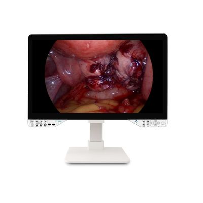 kopen 27 inch FHD 1080P Endoscopisch camerasysteem Alleen rigide endoscoop met monitor en 100W effectief optisch vermogen online vervaardiging