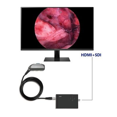 kopen TUYOU Draagbare endoscopie videocamera Full HD 1920x1080 Resolutie 120 graden Zichtveld voor Urologie Wervelkolom en ENT Chirurgie online vervaardiging