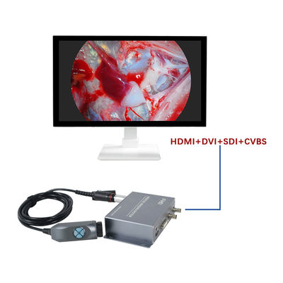 kopen Productie TUYOU Geïntegreerde Draagbare 1080P Medische Imaging Endoscopie Camera Voor Ent Neus- en Huisdierchirurgie online vervaardiging