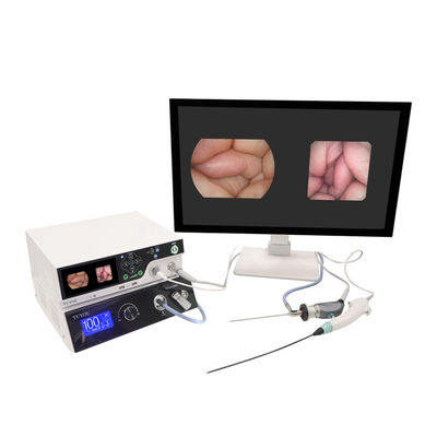 kopen TUYOU fabrikant 1080P beeldvormende apparatuur met rigide en flexibele endoscopie camera systeem voor ENT online vervaardiging