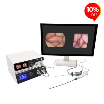kopen Fabrikant Medische Apparatuur: Dubbel Flexibel & Stijf Endoscopie Camerasysteem voor KNO-artsen en Urologie online vervaardiging