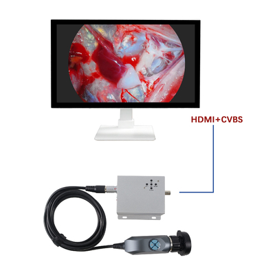 kopen Fabriek Groothandel 1080P Draagbare Endoscopiecamera Voor Veterinaire ENT-diagnose Gebruik online vervaardiging