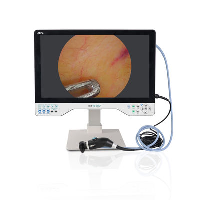 kopen TUYOU 24 inch 1080P endoscoopcamera met IPX8 waterdichtheid, 8 uur batterijduur en 2 jaar garantie voor medische endoscopie online vervaardiging