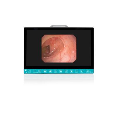 kopen TUYOU 13.3-Inch FHD Flexible Endoscope Camera System Multi-Color OEM Custom All-in-One Portable Uro-Gyn TikTok Hit online vervaardiging