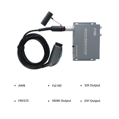 kopen Wireless Portable Endoscope Camera System - High Resolution for ENT/Orthopedics Clinical Examination online vervaardiging
