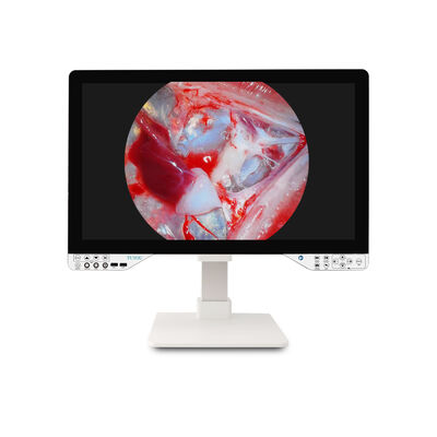 kopen Medische graad TUYOU 27 inch All-in-One Endoscopische Camera - FHD/4K voor ENT Laparoscopische Procedures online vervaardiging
