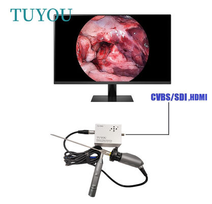 Full HD Elektrische Draagbare ENT Endoscoop Medische Camera Voor Laptop Computer