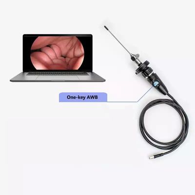 Elektrische Full HD CMOS Medische draagbare USB-endoscoopcamera Voor ENT Neus-otoscoop Oor Laparoscopische gynaecologie