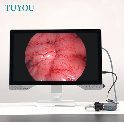 U Disk 27 inch 1080P Full HD 4 in 1 Medisch Arthroscoop System Hysteroscoop Endoscoop Camera