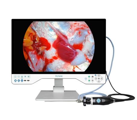 HD Endoscopie Camerasysteem met 80W Lichtbron en 3 Jaar Garantie
