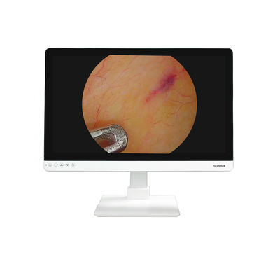 4K FHD Medische apparatuur 27 inch Endoscoopcamera Monitor Display Voor Endoscoop
