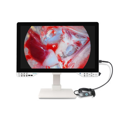 Innovatieve Full HD chirurgische endoscoopcamera met lichtbron en 27' monitor voor gynaecoloog