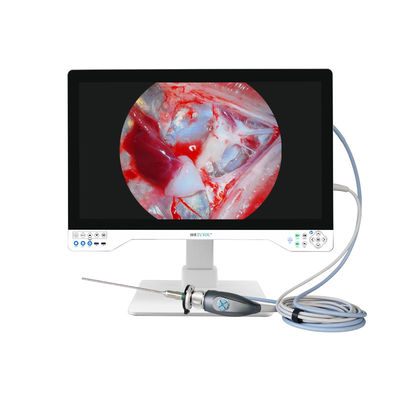 TUYOU 4K Rigid Endoscopy Camera System voor Cyst Fenestration Lever En ENT Chirurgie