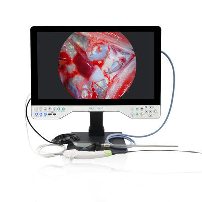 TUYOU 1080P Multifunctionele rigide en flexibele endoscoopcamerasysteem voor laparoscopie
