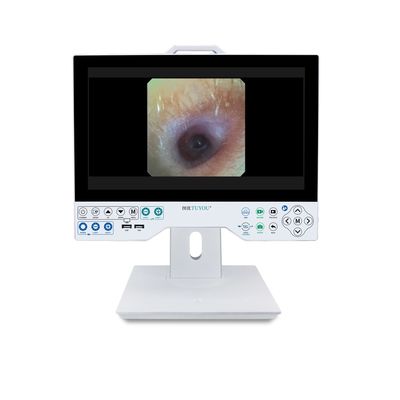 Alle in één rigide en flexibele endoscopiecamera TU-15LSD1E HDMI/SDI/CVBS/VGA/DVI-uitgangsinterface en ingebouwde lichtbron