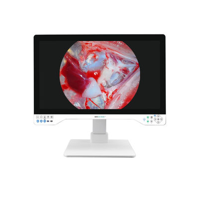 Geavanceerde 32