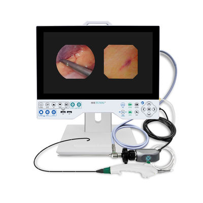 TUYOU Brain Surgery Tool All-in-One Rigid & Flexible Endoscopy Camera System voor baarmoederonderzoek