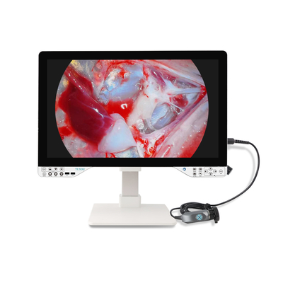 27-inch FHD endoscoop camerasysteem met 100W LED-licht voor KNO-chirurgie
