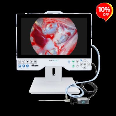 TUYOU 15,6 inch medische endoscoopcamera met ingebouwde LED-lichtbron SONY CMOS-sensor en multi-output interfaces voor laparoscopische urologie KNO