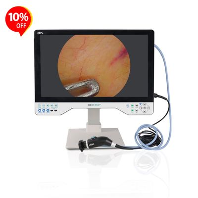 All-in-one Camera System With 24 Inches Monitor For Laparoscopy ENT Surgery Manufacturer 