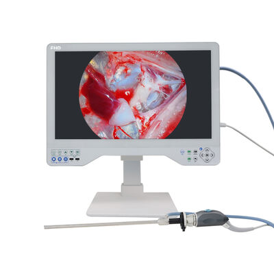 24 inch All-in-One Endoscoopcamerasysteem - HD-beeldvorming voor laparoscopische ENT-chirurgische procedures