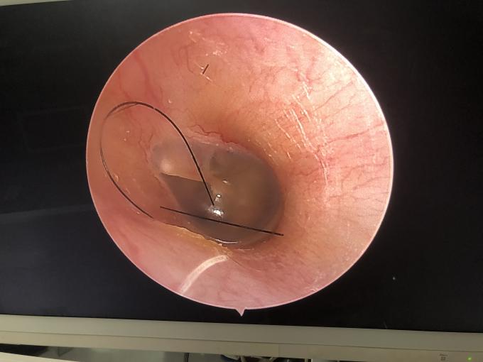 Draagbare LCD-monitor All In One HD Endoscopiecamera Voor ENT Laparoscopie Hysteroscopie Urologie 2