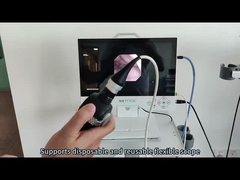 TU-15LSD1C All-in-One Endoscopy Camera System met Full HD-beeldvorming voor ENT en Laparoscopie