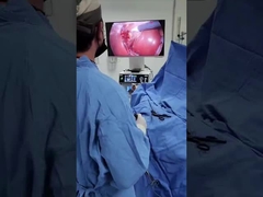 TU-LSD90TB 2-in-1-camerasysteem met koude lichtbron voor laparoscopie en ENT