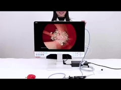 24in TUYOU Nasopharyngoscoop Endoscoop Camera Recorder voor High Definition Laparoscopy Operaties