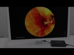 TUYOU High-Definition Endoscope Camera System voor neus-, oor- en laparoscopische procedures